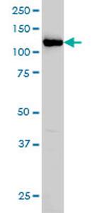 HIP1 Antibody in Western Blot (WB)