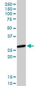 HLA-DMA Antibody in Western Blot (WB)