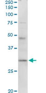 HLA-DMA Antibody in Western Blot (WB)