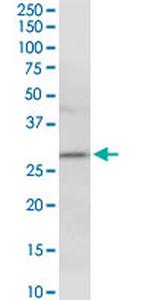 HLA-DMA Antibody in Western Blot (WB)