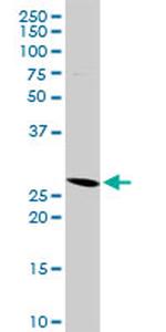 HLA-DMA Antibody in Western Blot (WB)