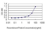 HLA-DMA Antibody in ELISA (ELISA)