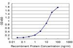 HLA-DMB Antibody in ELISA (ELISA)