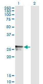 HLA-DMB Monoclonal Antibody (7D11)