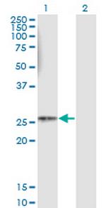 HLA-DMB Monoclonal Antibody (4D12)