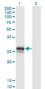 HLA-DMB Antibody in Western Blot (WB)
