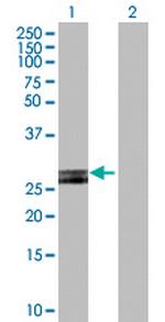 HLA-DOB Polyclonal Antibody, MaxPab™
