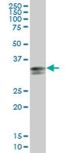 HLA-DPA1 Antibody in Western Blot (WB)
