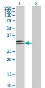 HLA-DPA1 Monoclonal Antibody (1E3)
