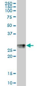 HLA-DPB1 Antibody in Western Blot (WB)