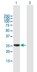 HLA-DPB1 Antibody in Western Blot (WB)
