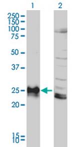 HLA-DPB1 Antibody in Western Blot (WB)