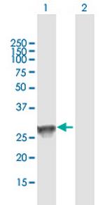 HLA-DQB1 Polyclonal Antibody, MaxPab™
