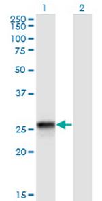 HLA-DQB2 Monoclonal Antibody (4C3)