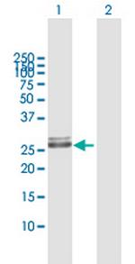 HLA-DRB1 Polyclonal Antibody, MaxPab™