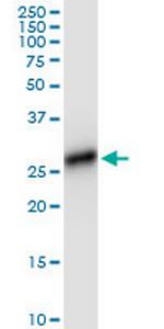 HLA-DRB4 Monoclonal Antibody (4C8)