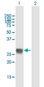 HLA-DRB5 Polyclonal Antibody, MaxPab™