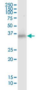 HLA-G Monoclonal Antibody (1D6)
