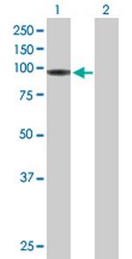 HLCS Polyclonal Antibody, MaxPab™