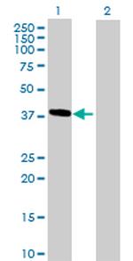 HMBS Antibody in Western Blot (WB)