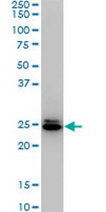 HMGB2 Monoclonal Antibody (4G7)