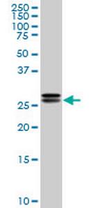 HMGB2 Monoclonal Antibody (3E5)