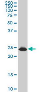 HMGB2 Monoclonal Antibody (X1)