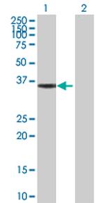 HMGCL Polyclonal Antibody, MaxPab™