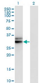 HMGCL Monoclonal Antibody (4F4-D1)
