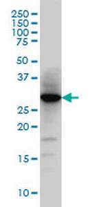 HNMT Monoclonal Antibody (3G12)