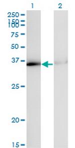 HNRPA1 Monoclonal Antibody (2E6)