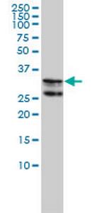 HNRPA2B1 Monoclonal Antibody (1G12-6C5)