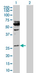 HOXA5 Polyclonal Antibody, MaxPab™
