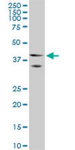 HOXA5 Monoclonal Antibody (1C9)