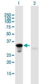 HOXA9 Polyclonal Antibody, MaxPab™