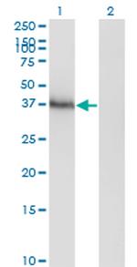 HOXA11 Monoclonal Antibody (8B8)