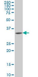 HOXA11 Monoclonal Antibody (5A3)