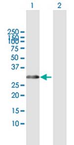 HOXB1 Polyclonal Antibody, MaxPab™