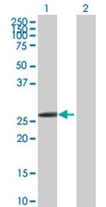 HOXB1 Polyclonal Antibody, MaxPab™