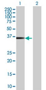 HOXB5 Antibody in Western Blot (WB)
