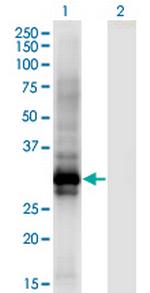 HOXB6 Monoclonal Antibody (8E3)