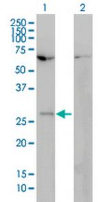 HOXB7 Monoclonal Antibody (4F9)