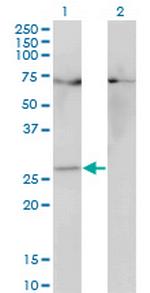 HOXB7 Monoclonal Antibody (3F3)