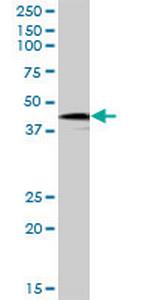 HOXB9 Polyclonal Antibody, MaxPab™