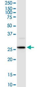 HOXB9 Antibody in Western Blot (WB)