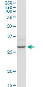 HOXB9 Antibody in Western Blot (WB)