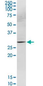 HOXB9 Antibody in Western Blot (WB)