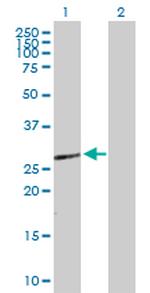 HOXB9 Polyclonal Antibody, MaxPab™
