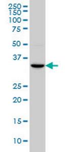 HOXC4 Monoclonal Antibody (1E9)