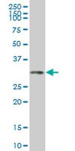 HOXC4 Antibody in Western Blot (WB)